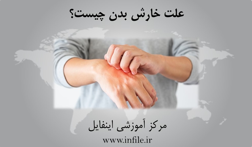 علت خارش زیاد بدن