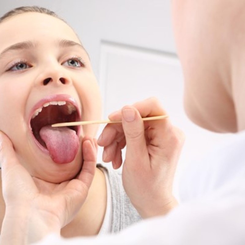علت آفت دهان در کودکان