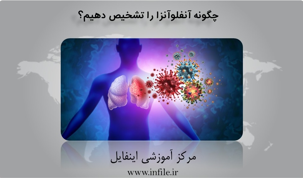 علائم آنفولانزا